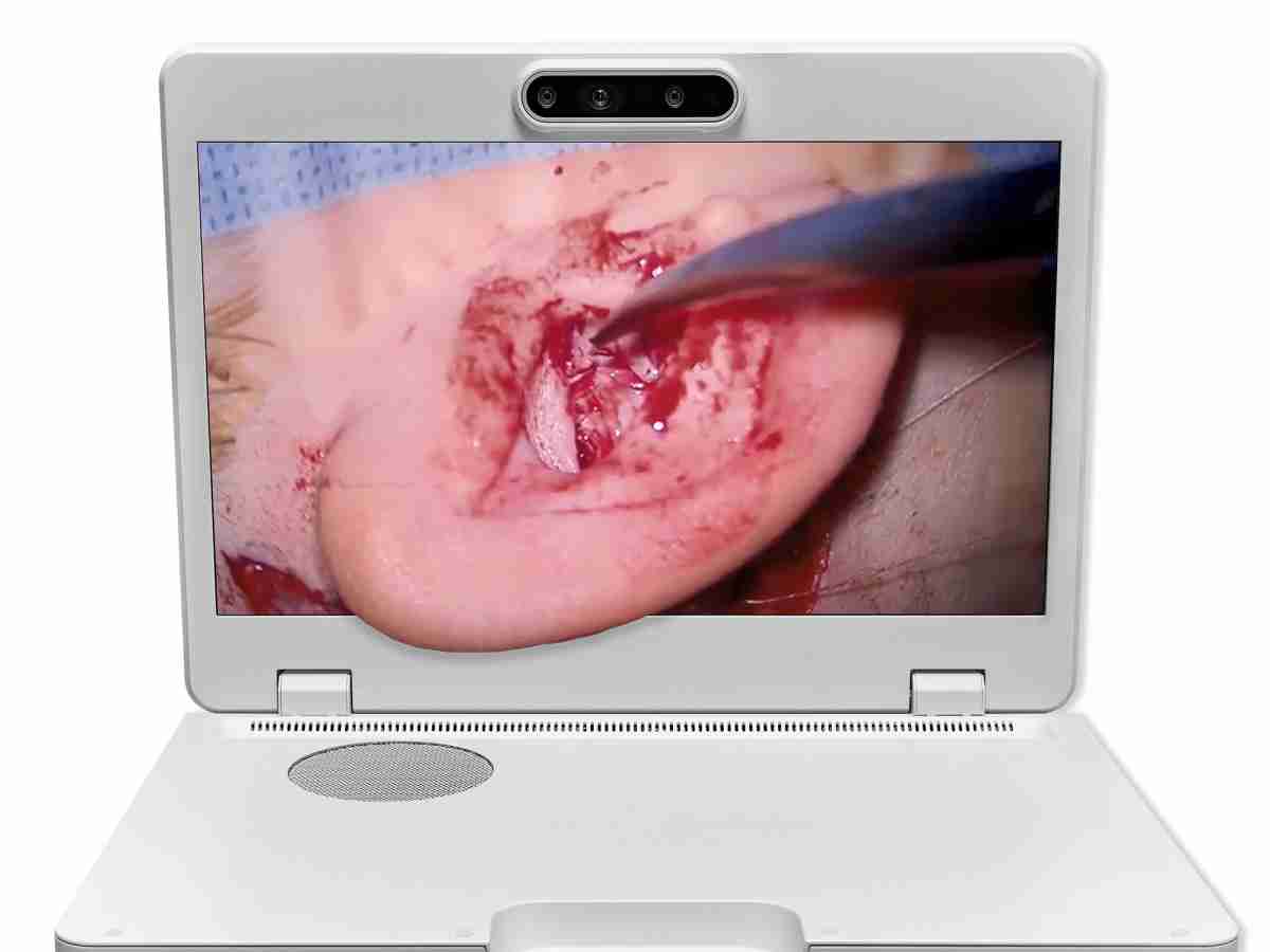 达擎之＂Heads-up 3D显微手术显示系统＂，，，，整合4K裸眼3D显示及眼球追踪系统，，，，具备快速追踪人眼移动位置功能，，，，减轻医师长时间维持固定姿势的负担，，，让医师能有更宽广清晰的3D立体视野及更舒适的姿势来执行手术。。。